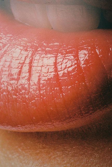 Aumento e hidratación de labios